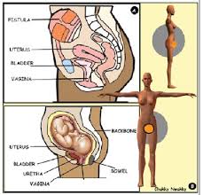 festula