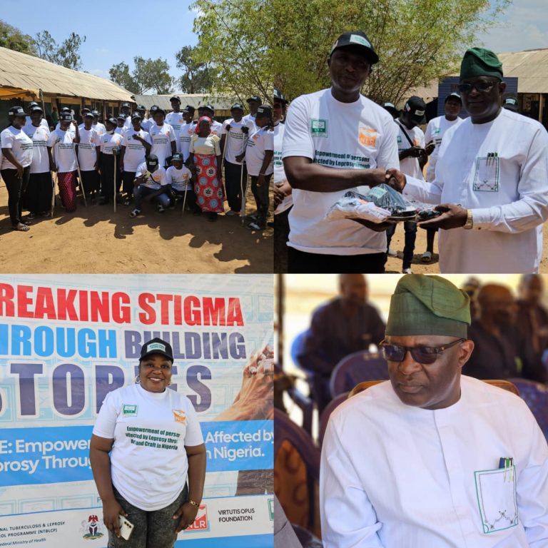 Plateau govt pledges N5m as LTR trains leprosy-affected persons